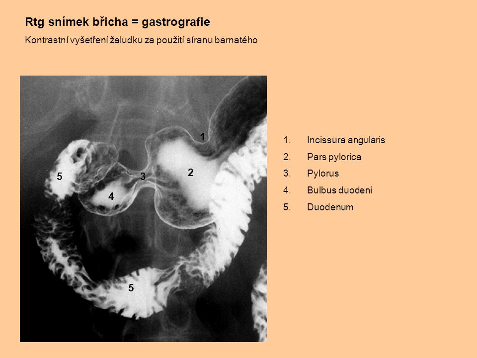 Rtg snímek břicha = gastrografie