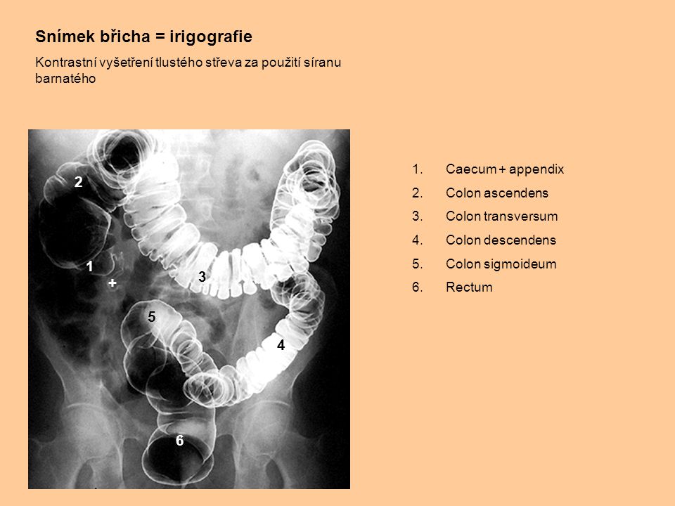 Snímek břicha = irigografie