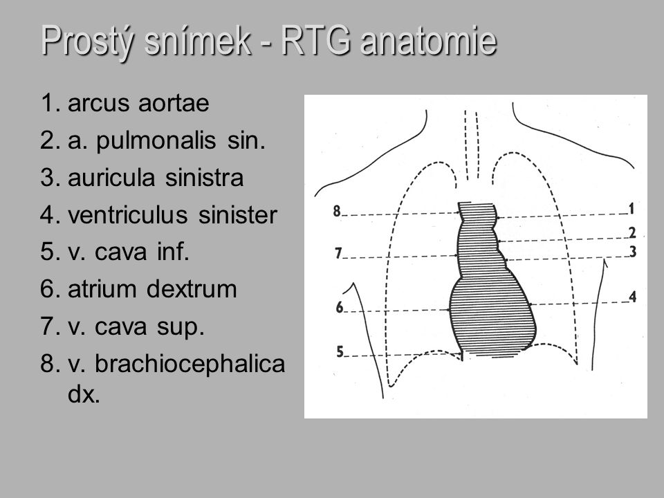 Prostý snímek - RTG anatomie