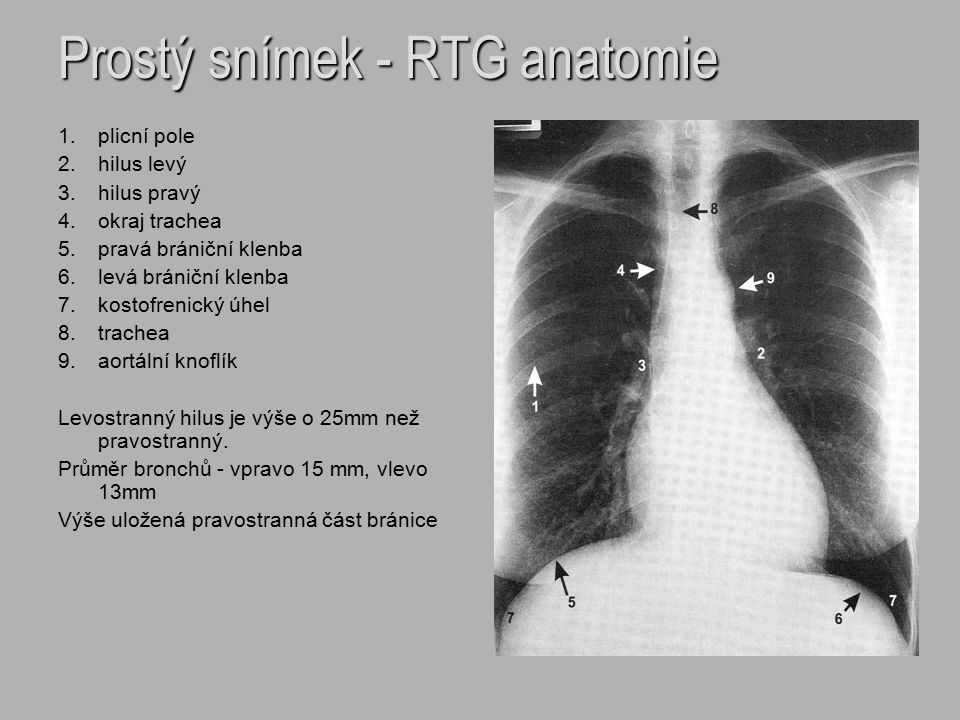 Prostý snímek - RTG anatomie