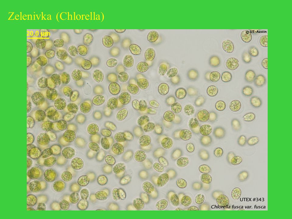Zelenivka (Chlorella)